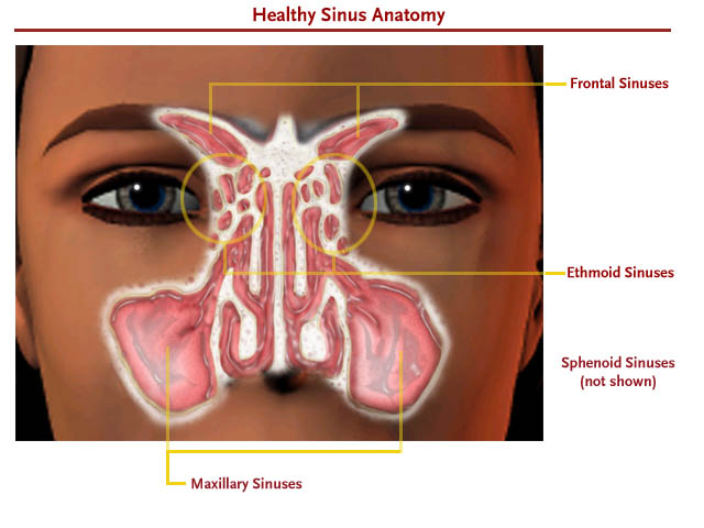 Blocked Sinuses